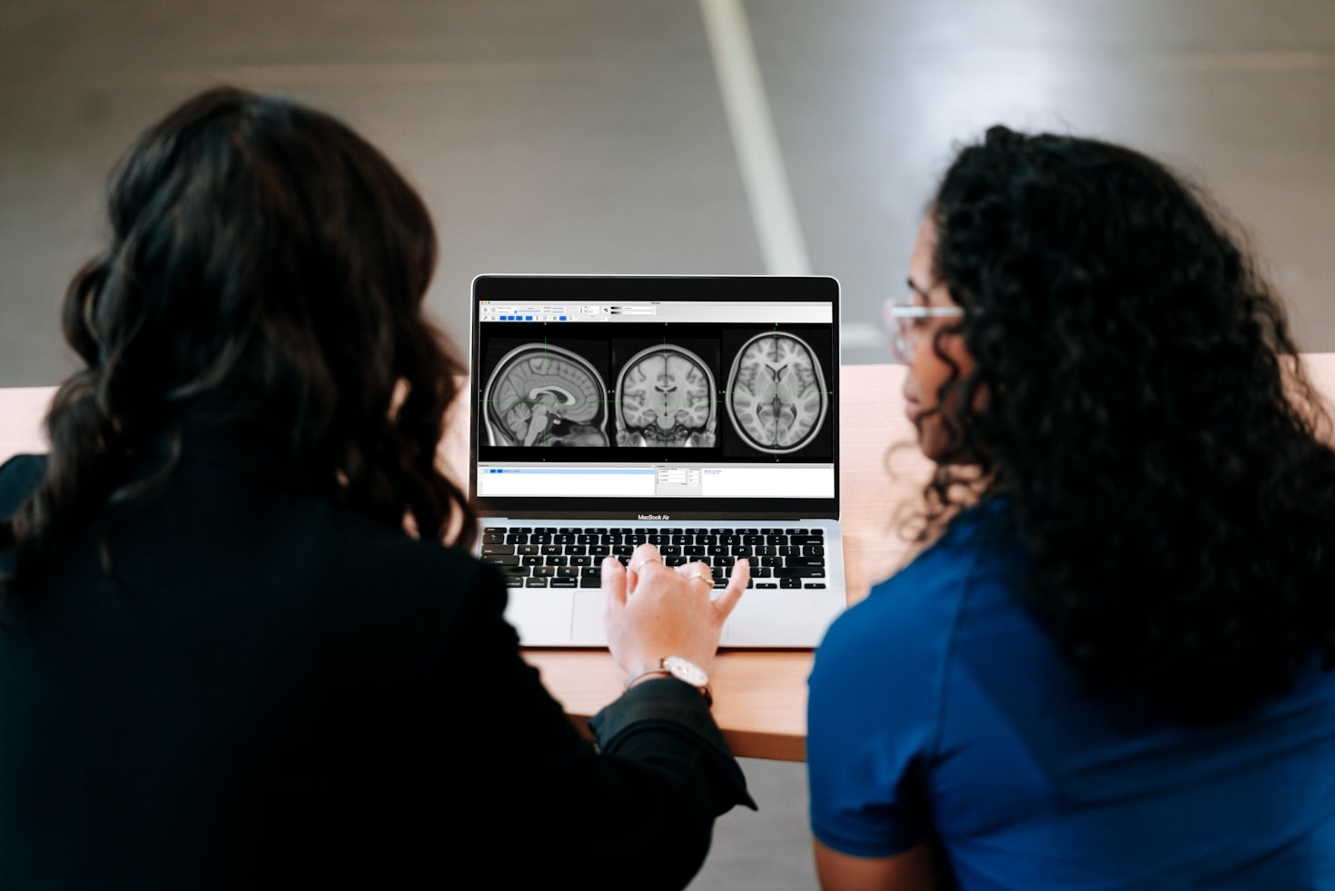 Spitzenmanagement und Neuro-Leadership im Vergleich